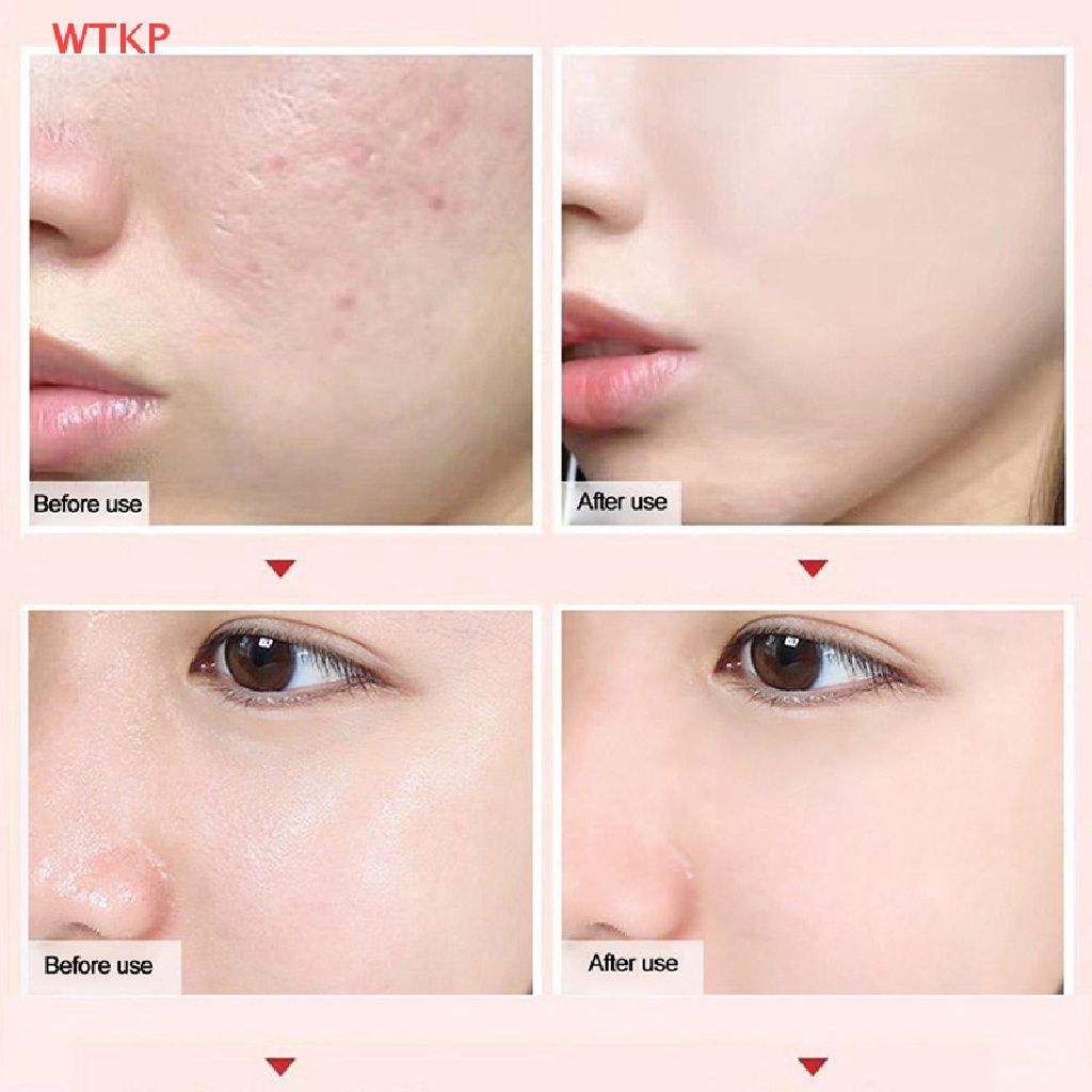 Miniatura 2 de BARRA POROS INVISIBLE NICOR - BIOTEZ